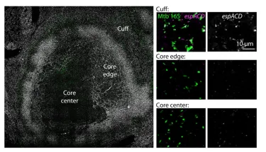 images of Mycobacterium tuberculosis, the pathogen that causes tuberculosis