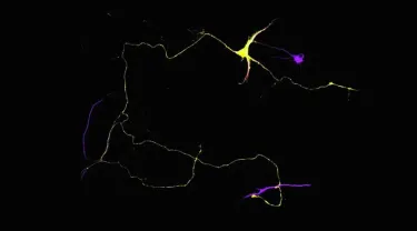 Mouse hippocampal neuron expressing a green fluorescence protein (GFP, yellow) making synaptic contacts with other neurons in cultures stained for microtubule associated protein 2B (MAP2B, magenta)