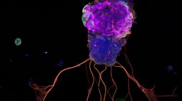 A representative picture of an organoid grown by Brian Lin and team - in fact, the researchers said, it was the first one they ever saw.
