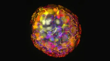 A spherical multicellular object, with multiple colors