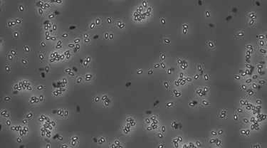 Black and white image of tiny white, gray, and black bacterial spores against a dark gray background