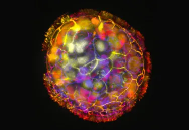 A spherical multicellular object, with multiple colors