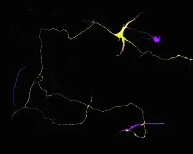Mouse hippocampal neuron expressing a green fluorescence protein (GFP, yellow) making synaptic contacts with other neurons in cultures stained for microtubule associated protein 2B (MAP2B, magenta)