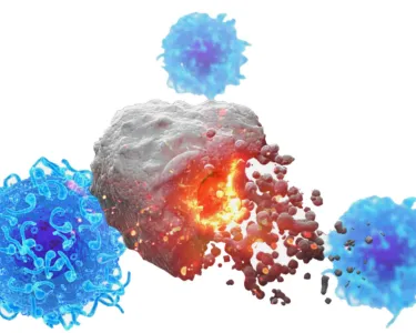 A gray colored sphere breaking apart, with three blue spheres surrounding it. A new cancer method induces immune responses that suppressed multiple tumors in pre-clinical models 