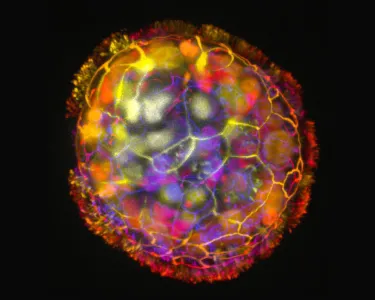 A spherical multicellular object, with multiple colors
