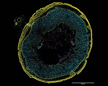 A colorful image shows a round cross-section of inflamed gut tissue. Tiny green squiggles represent C. diff cells where toxin genes are turned on throughout the tissue layers colored yellow or cyan. The magenta highlights the subset of C. diff that do not express the toxin genes.