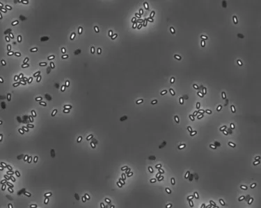 Black and white image of tiny white, gray, and black bacterial spores against a dark gray background