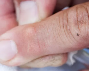 Close-up photograph shows a tiny black-legged crawling on a finger